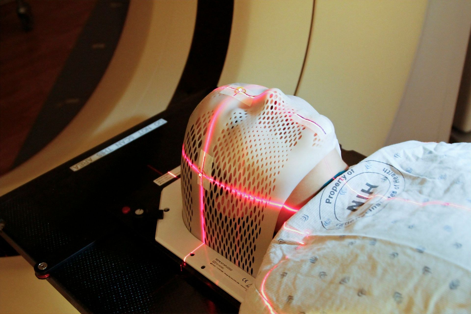 Laser therapy to remove dark spots (Image by NCI/Unsplash)